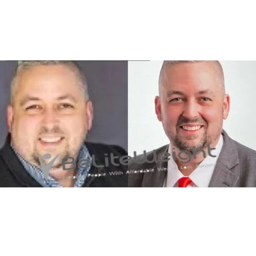 Weight Loss Surgery Gastric Sleeve before and after Brian B - 1 Year Update*